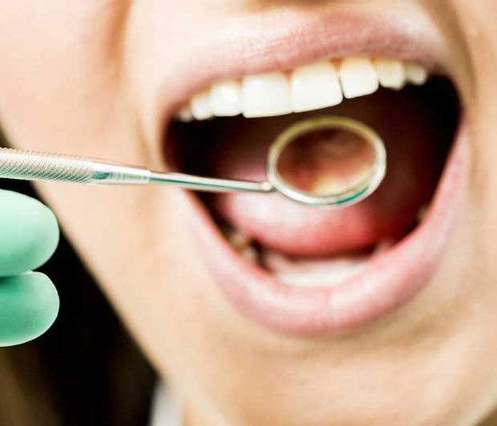 Proper Dental Hygiene Routine According to Dentists
